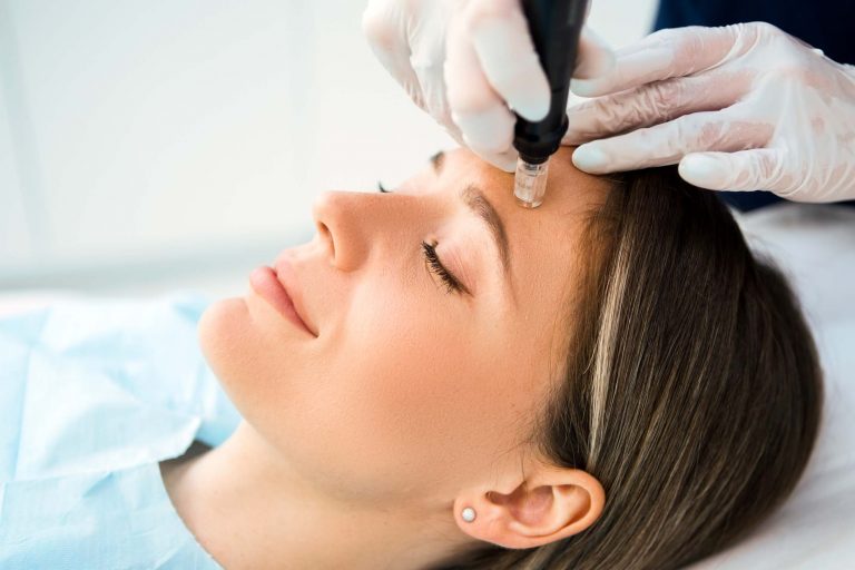 Microneedling and Laser